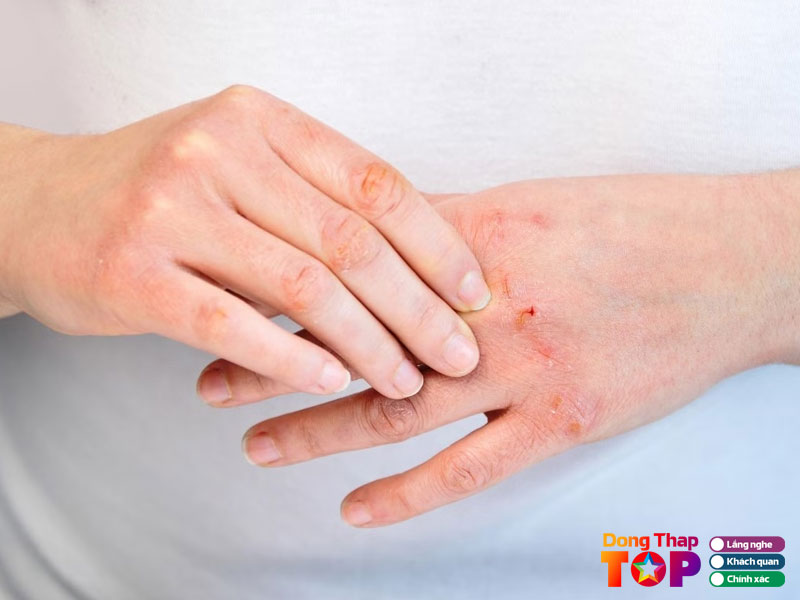 Phong-kham-da-lieu-phan-viet-dung-dongthaptoplist