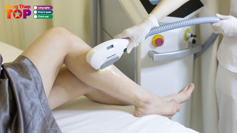 Top-10-spa-triet-long-o-dong-thap-tri-tan-goc-an-toan-cho-da-dongthaptoplist