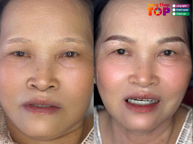 Spa-huynh-huynh-dongthaptoplist